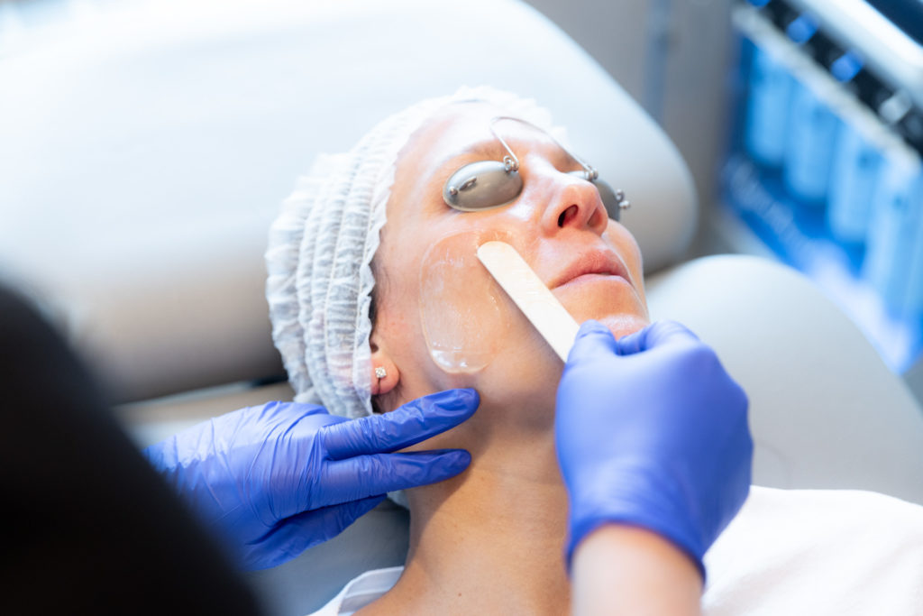 applying gel to woman's face with gloves