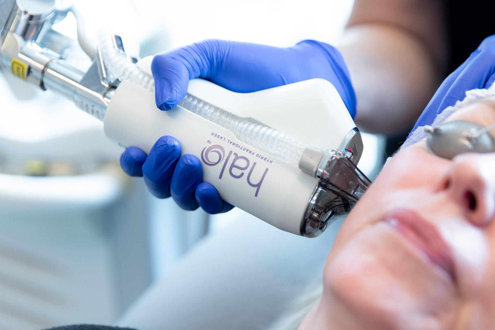 HALO device being used on patient