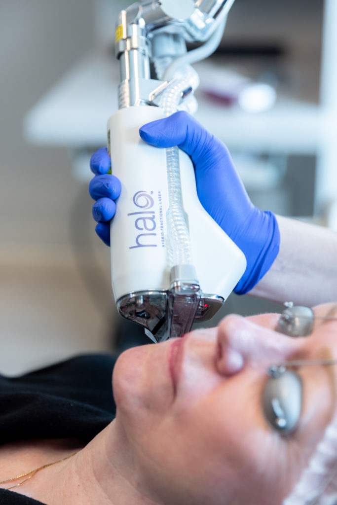 HALO device being used during treatment