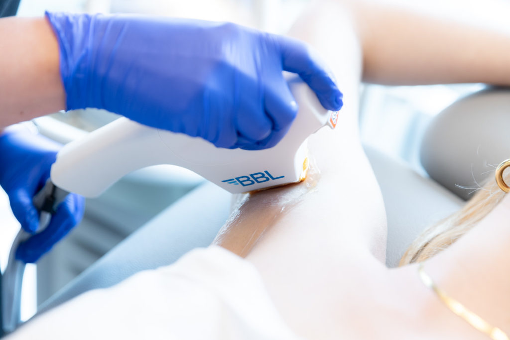 Laser Hair Reduction device close up on armpit