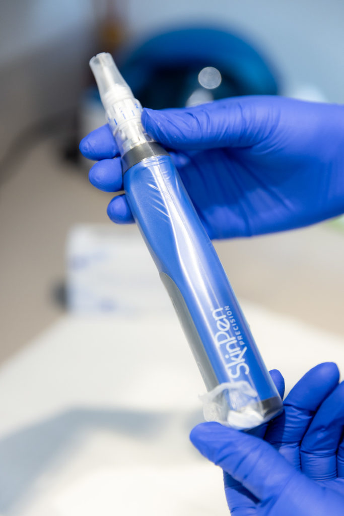 Microneedling device being held