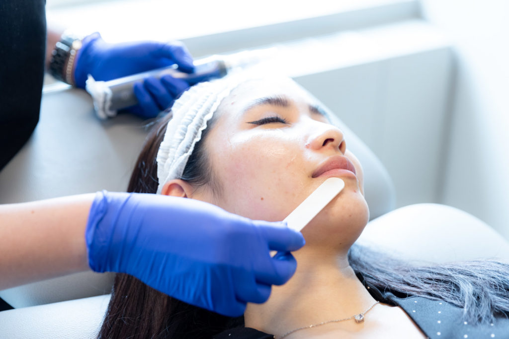 Microneedling with specialist rubbing solution on patient